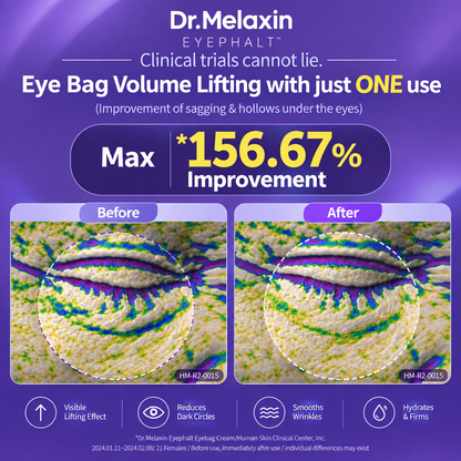 Dr. Melaxin Eyephalt Eye Cream for Eye Bags 10ml